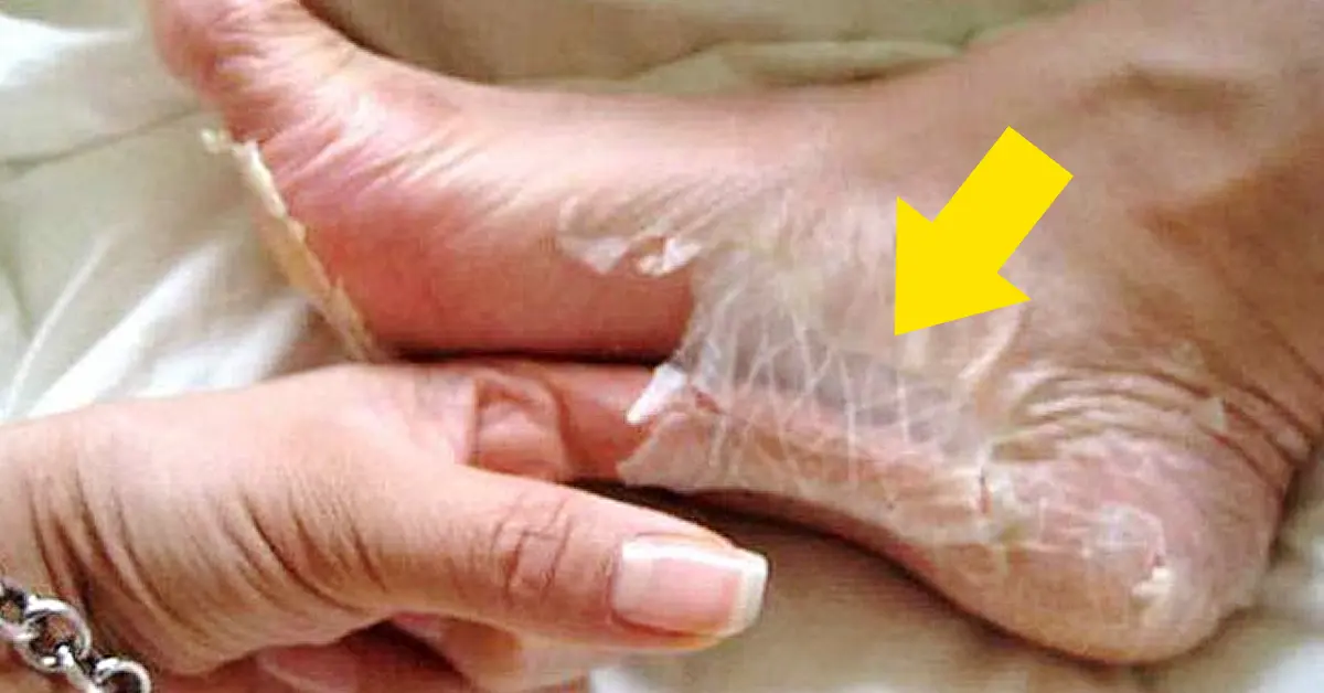 17 pesadillas que solo entenderán quienes odian los pies