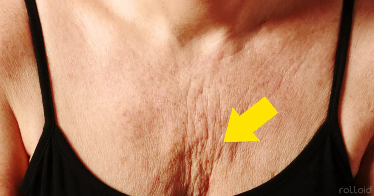 7 Trucos y secretos para prevenir y tratar las arrugas de la zona del escote