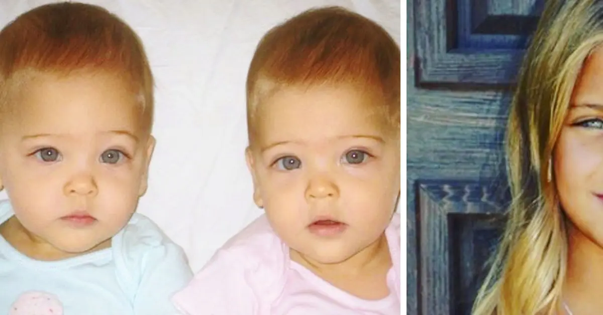 Estas dos gemelas han crecido hasta convertirse en las gemelas más guapas del mundo