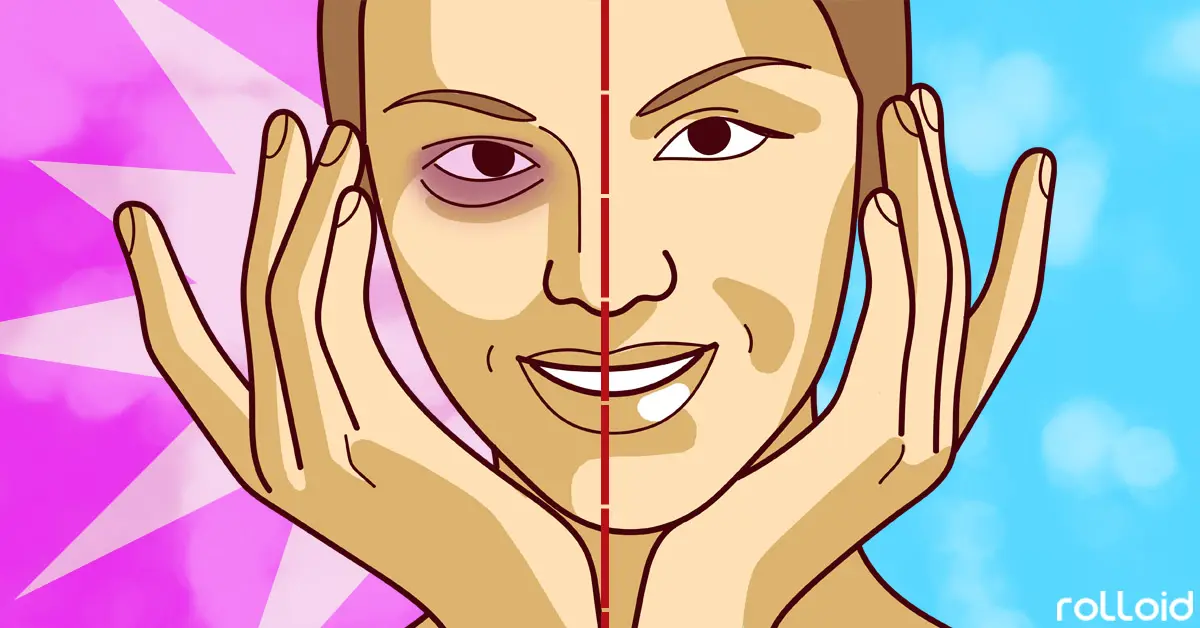 10 Trucos rápidos para eliminar bolsas, ojeras e hinchazón de tus ojos